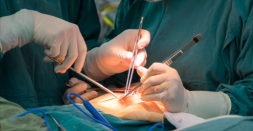 General surgery care at Narayana Hospital